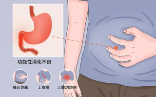 克罗恩病症状解析-最常见的表现与应对策略