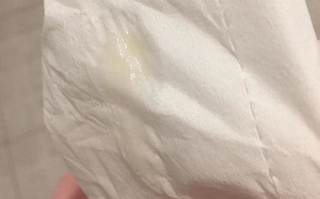 女性分泌物解析-了解下面黏黏液体原因及应对方法