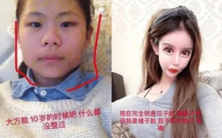 2025年娱乐圈揭秘：明星整容背后的秘密与影响