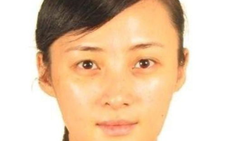 盘点2025年娱乐圈：脸上有痣的男明星独特魅力