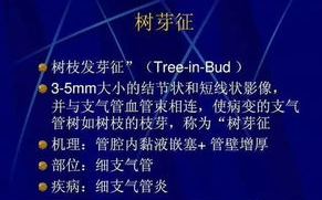 极致偏爱1vs2现象解析-个性化消费趋势洞察