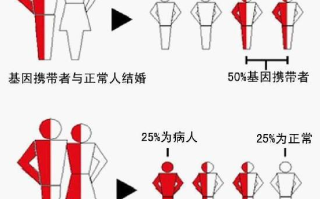 溶血性贫血,能否根治-治疗方法与治愈可能性解析