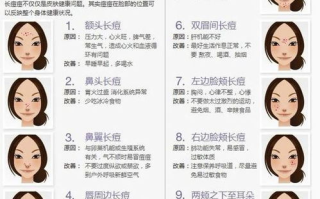 去除痘痘的有效方法与护理策略-皮肤健康解析