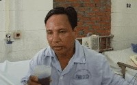 美国男子换肾后莫名感染狂犬病死亡！病毒来自捐赠者