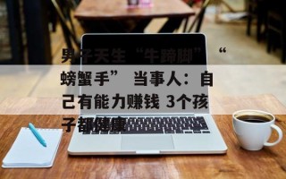 男子天生“牛蹄脚”“螃蟹手” 当事人：自己有能力赚钱 3个孩子都健康