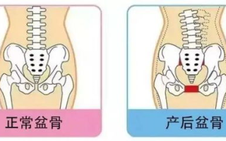 产后盆底肌肉恢复,紧致度提升-有效锻炼与注意事项解析