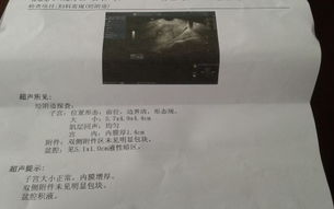 女生流出白白的东西原因及处理方法解析