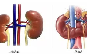 避免腰疼，正确抬举重物的方法与技巧解析