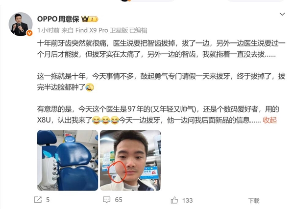OPPO周意保去拔牙 牙医是O粉：一边拔牙一边问新机消息-第2张图片-佛山资讯网
