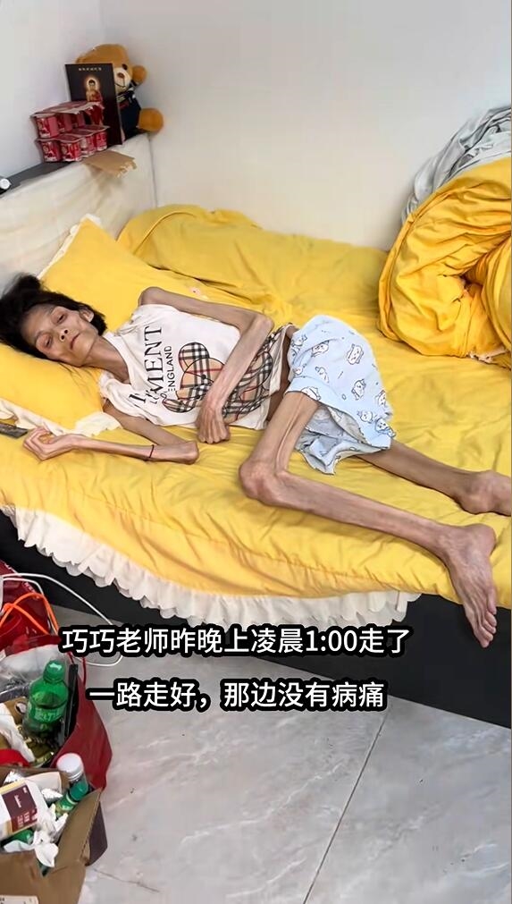 与病魔抗争2年 胃萎缩暴瘦至35斤女子去世:年仅27岁-第3张图片-佛山资讯网 与病魔抗争2年 胃萎缩暴瘦至35斤女子去世:年仅27岁-第3张图片-佛山资讯网