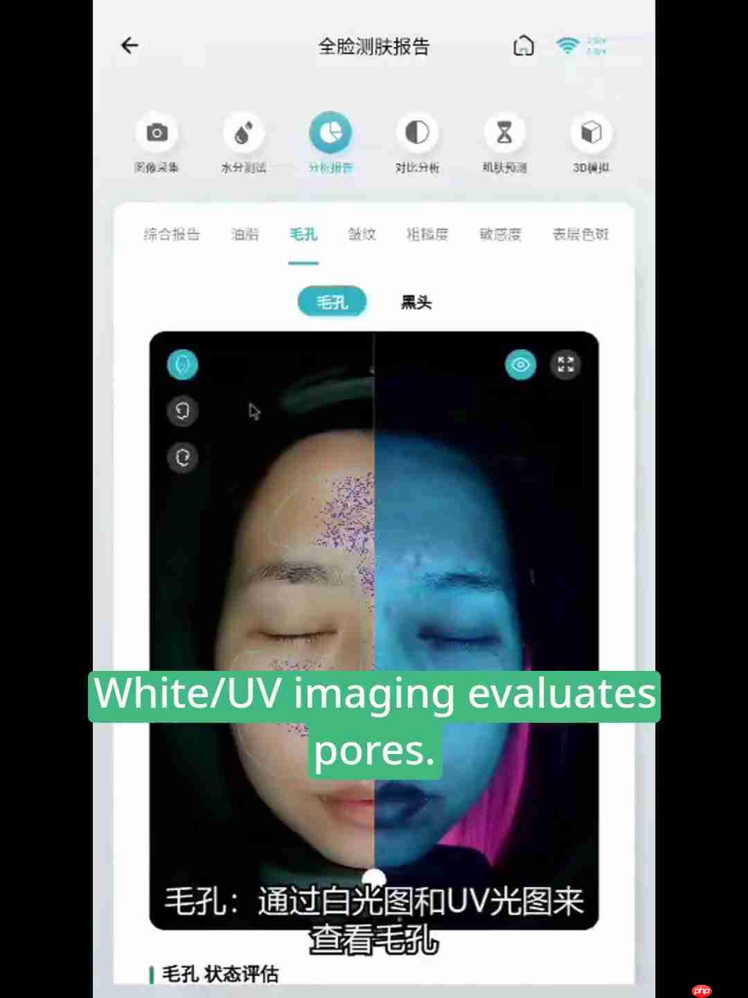 深度皮肤检测报告解读：16D成像分析，精准护肤指南-第5张图片-佛山资讯网