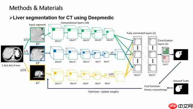 Deepmedic:CT肝脏分割深度学习方法解析与临床应用-第3张图片-佛山资讯网 Deepmedic:CT肝脏分割深度学习方法解析与临床应用-第3张图片-佛山资讯网