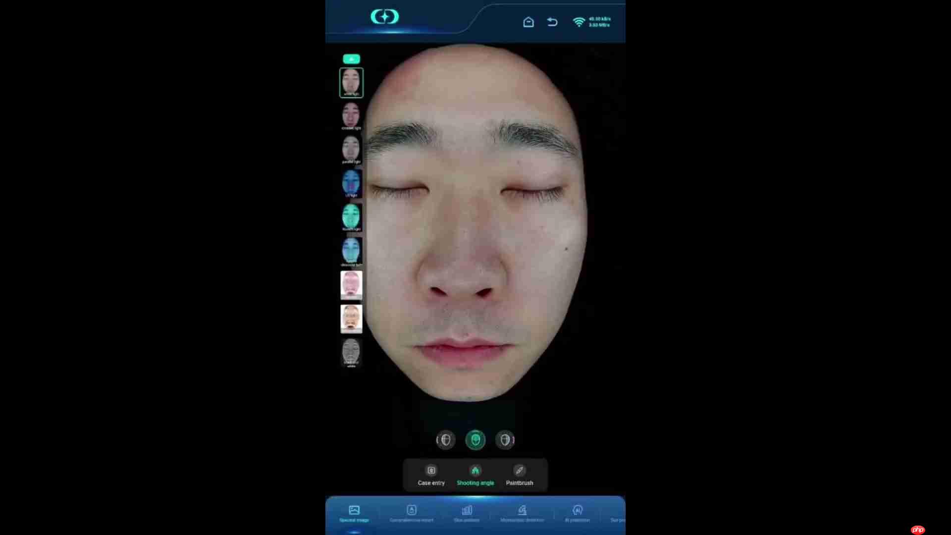 皮肤分析仪深度测评：光谱成像技术揭秘肌肤问题-第4张图片-佛山资讯网