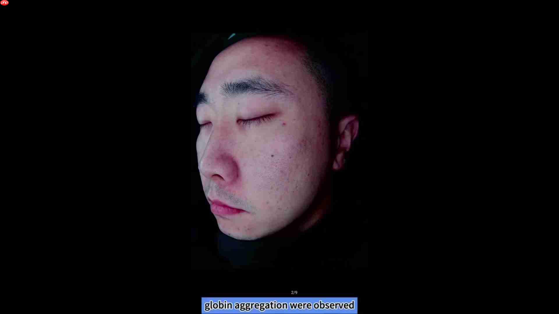 皮肤分析仪深度测评：光谱成像技术揭秘肌肤问题-第5张图片-佛山资讯网
