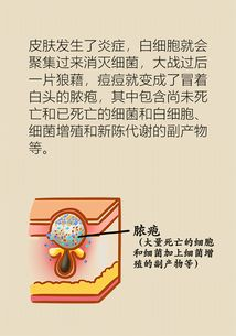 40岁女人私处毛发浓密处理方法-美容护肤与个人护理指南-第2张图片-佛山资讯网