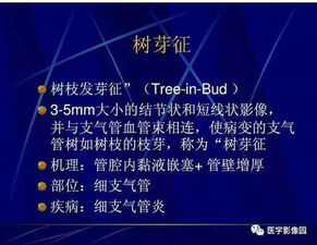 极致偏爱1vs2现象解析-个性化消费趋势洞察-第1张图片-佛山资讯网