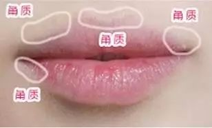 打造热情迷唇，唇部护理与流行趋势解析-第2张图片-佛山资讯网